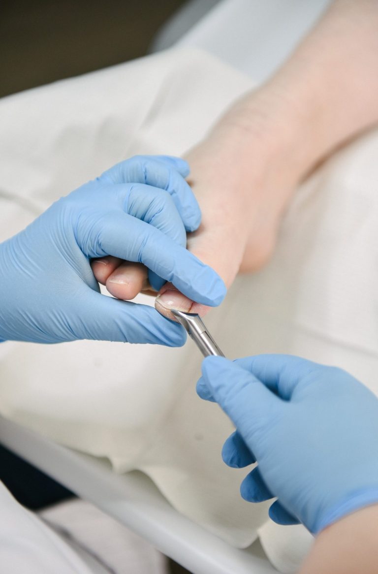 Nagels knippen
